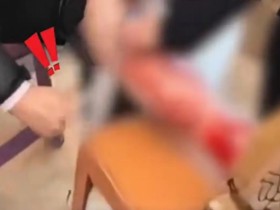 裤子单薄血管冻爆!哈尔滨民警急救静脉血管破裂男子