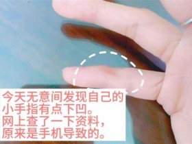 小心手指变形!用小拇指做手机支架的受害者出现了!